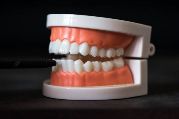 Dentist hand point pen to lower incisor front tooth of teeth and jaw anatomy model isolated on black background with copy space for text. dental care and orthodontic education concept.