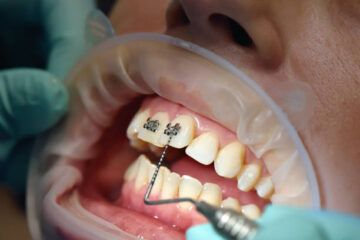 Orthodontics