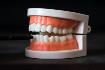 Implants